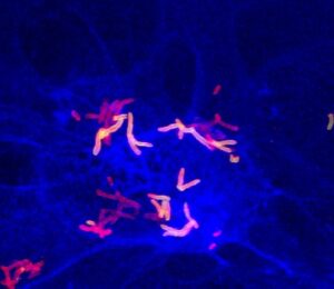 The Coryne Bacterium (Bild: FAU, PD Dr. Bäumer)